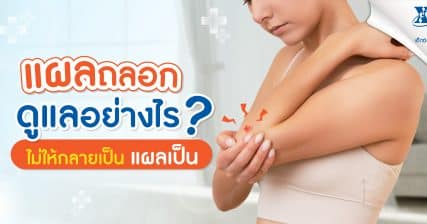 แผลถลอก ดูแลอย่างไรไม่ให้กลายเป็นแผลเป็น