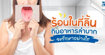 ร้อนในที่ลิ้น กินอาหารลำบาก จะรักษาอย่างไร