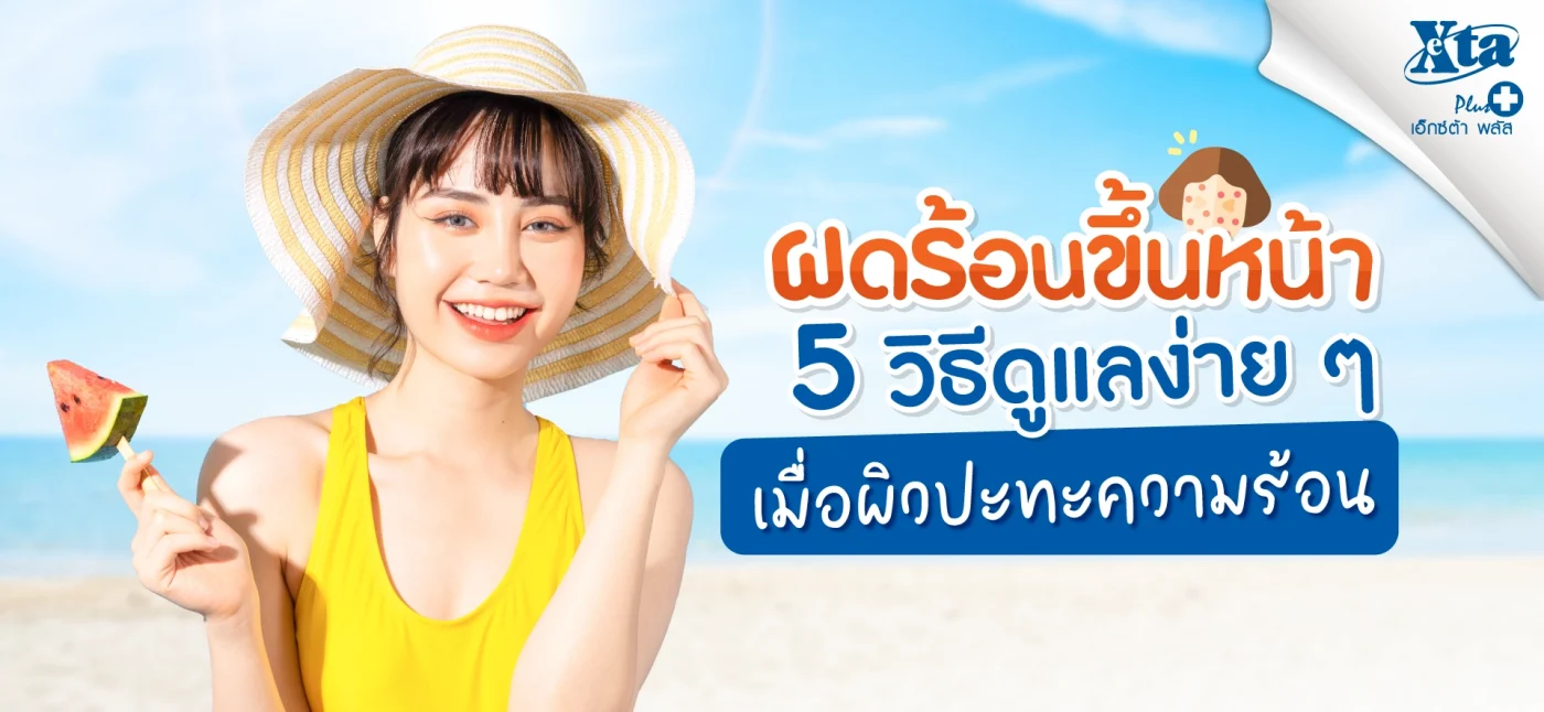 ผดร้อนขึ้นหน้า เมื่อผิวปะทะความร้อน! 5 วิธีดูแลง่าย ๆ