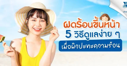 ผดร้อนขึ้นหน้า เมื่อผิวปะทะความร้อน! 5 วิธีดูแลง่าย ๆ
