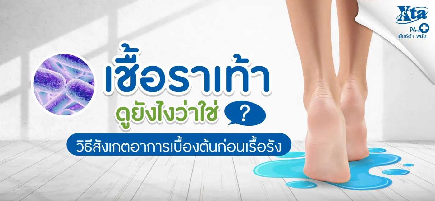 เชื้อรา เท้า ดูยังไงว่าใช่ ? วิธีสังเกตอาการเบื้องต้นก่อนเรื้อรัง eXta Plus