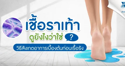 เชื้อรา เท้า ดูยังไงว่าใช่ ? วิธีสังเกตอาการเบื้องต้นก่อนเรื้อรัง eXta Plus