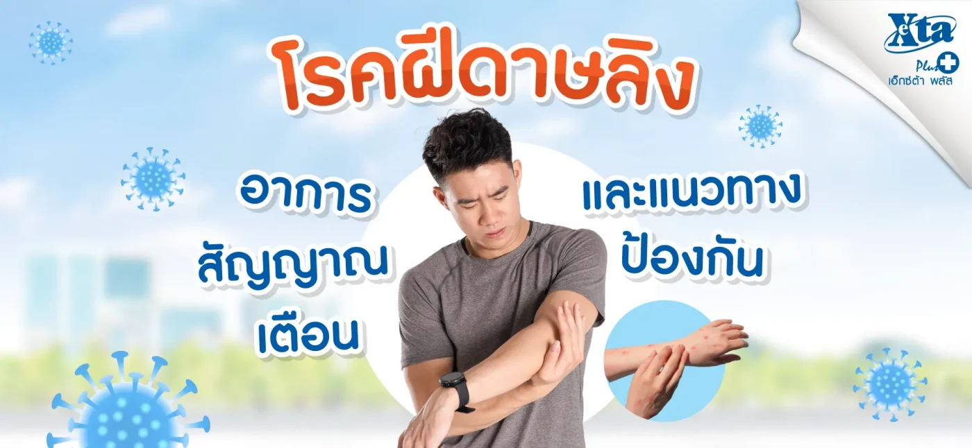 โรค ฝีดาษ ลิง อาการ สัญญาณเตือนและแนวทางป้องกัน ร้านยา เอ็กซ์ต้า พลัส