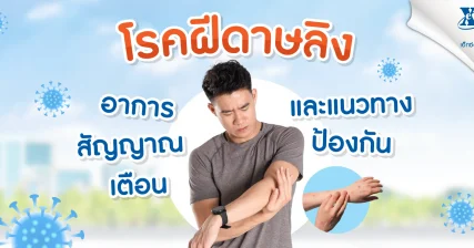 โรค ฝีดาษ ลิง อาการ สัญญาณเตือนและแนวทางป้องกัน ร้านยา เอ็กซ์ต้า พลัส