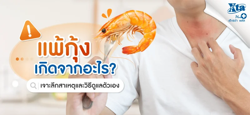 แพ้กุ้ง เกิดจากอะไร? เจาะลึกสาเหตุและวิธีดูแลตัวเอง ร้านยา เอ็กซ์ต้า พลัส