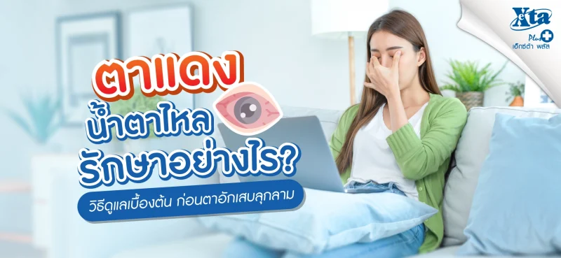 ตาแดง น้ำตาไหล รักษาอย่างไร วิธีดูแลเบื้องต้นก่อนลุกลาม จาก เอ็กซ์ต้า พลัส