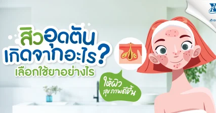 สิวอุดตันเกิดจากอะไร เลือกใช้ยารักษาอย่างไร ให้ผิวดีขึ้น คำแนะนำจากร้านยา เอ็กซ์ต้า พลัส