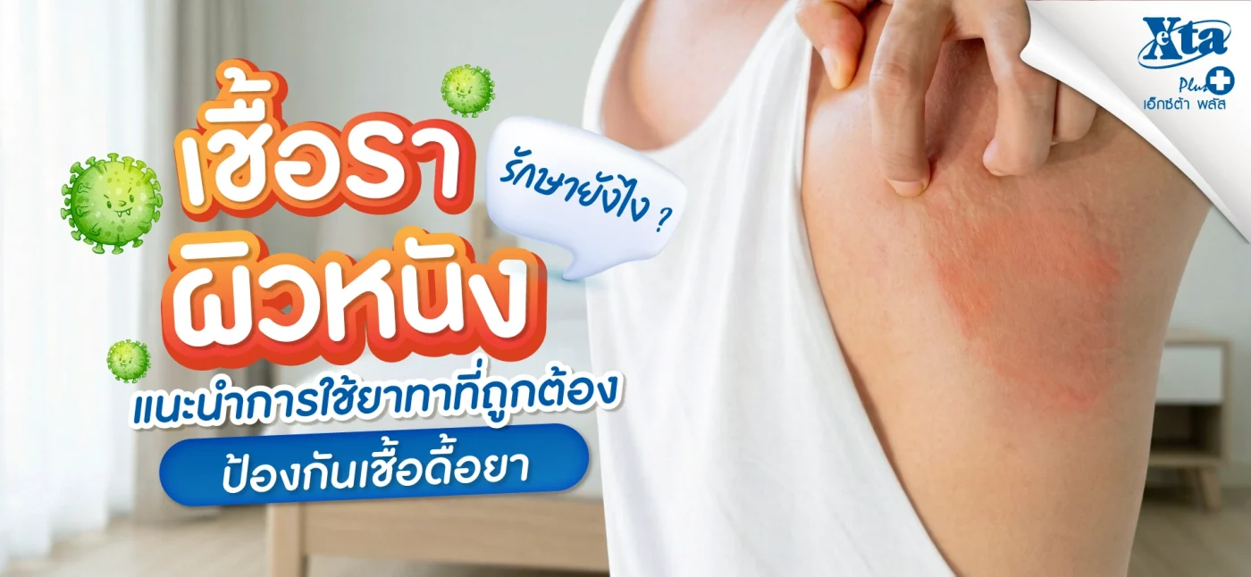 เชื้อราผิวหนังรักษายังไง แนะนำวิธีใช้ยา ป้องกันเชื้อดื้อยา