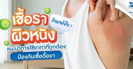 เชื้อราผิวหนังรักษายังไง แนะนำวิธีใช้ยา ป้องกันเชื้อดื้อยา