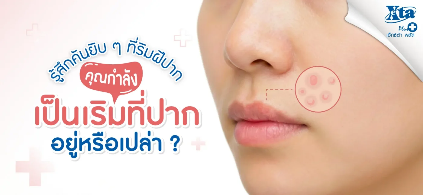 คันยิบ ๆ ที่ริมฝีปาก สัญญาณเตือน “เป็นเริมที่ปาก” หรือเปล่า ร้านยา เอ็กซ์ต้า พลัส