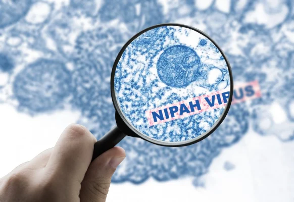ไวรัสนิปาห์ (Nipah Virus) คืออะไร?