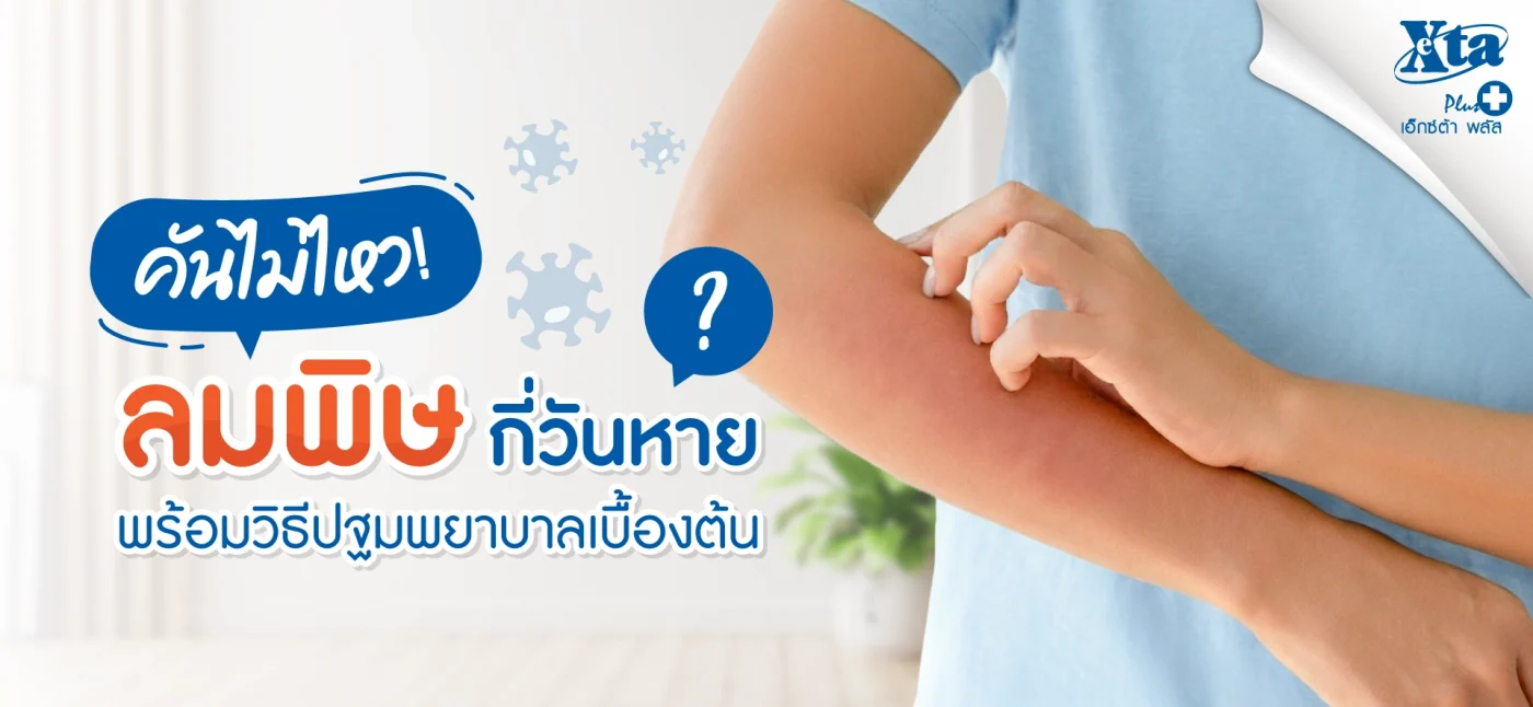 คันไม่ไหว ลมพิษ กี่วันหาย? รวมวิธีปฐมพยาบาลเบื้องต้น ร้านยา เอ็กซ์ต้า พลัส