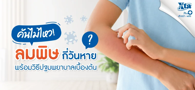 คันไม่ไหว ลมพิษ กี่วันหาย? รวมวิธีปฐมพยาบาลเบื้องต้น ร้านยา เอ็กซ์ต้า พลัส