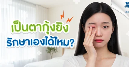 เป็นตากุ้งยิง รักษาเองได้ไหม? สัญญาณเตือนที่ควรพบแพทย์